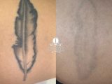 iBeauty feather tattoo progress comparison