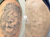 iBeauty lion tattoo progress comparison